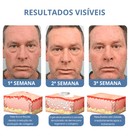 Creme Veze - Levanta Pálpebras Caídas e Reduz Rugas Dos Olhos
